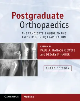 Banaszkiewicz / Kader |  Postgraduate Orthopaedics | Buch |  Sack Fachmedien