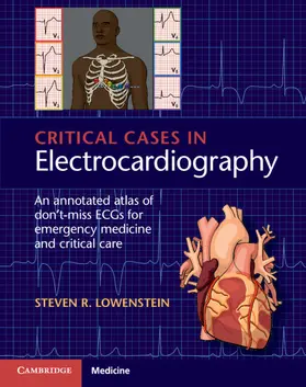 Lowenstein |  Critical Cases in Electrocardiography | Buch |  Sack Fachmedien