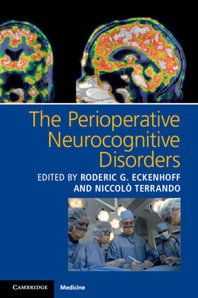 Eckenhoff / Terrando |  The Perioperative Neurocognitive Disorders | Buch |  Sack Fachmedien