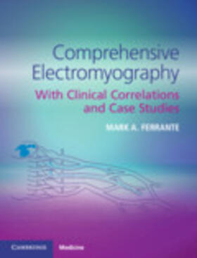 Ferrante |  Comprehensive Electromyography | Buch |  Sack Fachmedien
