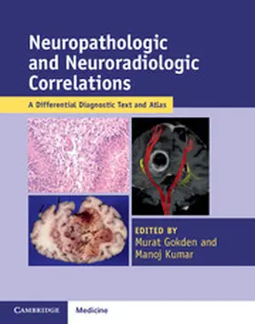 Gokden / Kumar |  Neuropathologic and Neuroradiologic Correlations | Buch |  Sack Fachmedien