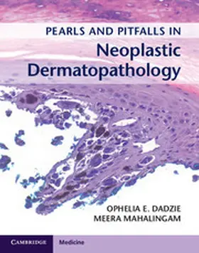 Dadzie / Mahalingam |  Pearls and Pitfalls in Neoplastic Dermatopathology with Online Access | Buch |  Sack Fachmedien