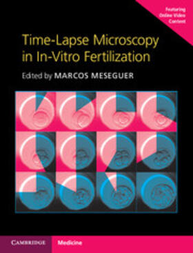 Meseguer |  Time-Lapse Microscopy in In-Vitro Fertilization | Buch |  Sack Fachmedien