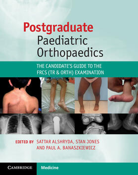 Alshryda / Jones / Banaszkiewicz |  Postgraduate Paediatric Orthopaedics: The Candidate's Guide to the Frcs (Tr and Orth) Examination | Buch |  Sack Fachmedien