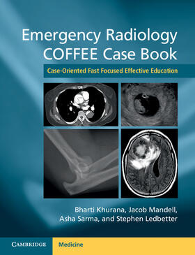 Khurana / Mandell / Sarma |  Emergency Radiology Coffee Case Book | Buch |  Sack Fachmedien