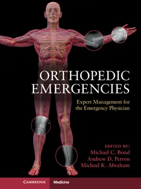 Bond |  Orthopedic Emergencies | Buch |  Sack Fachmedien