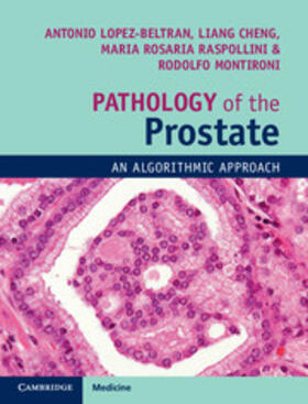 Lopez-Beltran / Cheng / Montironi |  Pathology of the Prostate | Buch |  Sack Fachmedien