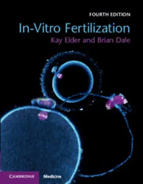 Dale / Elder |  In-Vitro Fertilization | Buch |  Sack Fachmedien