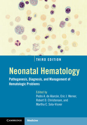 Werner / de Alarcón / Sola-Visner |  Neonatal Hematology | Buch |  Sack Fachmedien