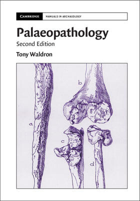 Waldron |  Palaeopathology | Buch |  Sack Fachmedien