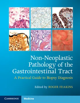 Feakins |  Non-Neoplastic Pathology of the Gastrointestinal Tract with Online Resource | Buch |  Sack Fachmedien