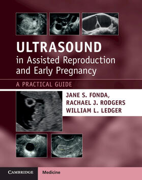 Fonda / Rodgers / Ledger |  Ultrasound in Assisted Reproduction and Early Pregnancy | Buch |  Sack Fachmedien