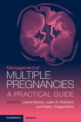 Thilaganathan / Bricker / Robinson |  Management of Multiple Pregnancies | Buch |  Sack Fachmedien