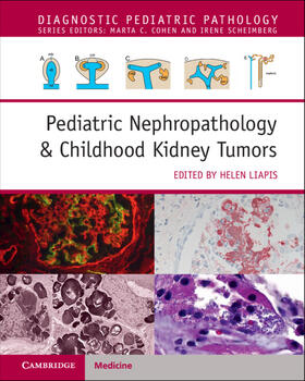 Liapis |  Pediatric Nephropathology & Childhood Kidney Tumors with Online Resource | Buch |  Sack Fachmedien