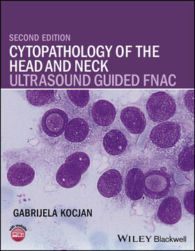 Kocjan |  Cytopathology of the Head and Neck | Buch |  Sack Fachmedien