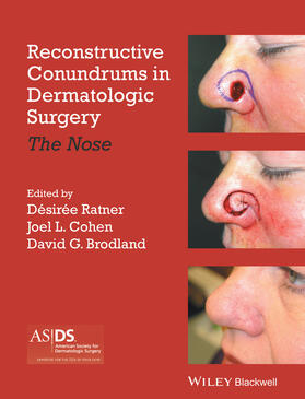 Ratner / Cohen / Brodland |  Reconstructive Conundrums in Dermatologic Surgery | Buch |  Sack Fachmedien