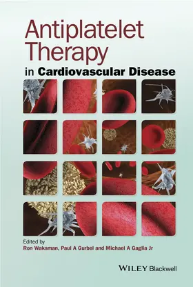 Waksman / Gurbel / Gaglia |  Antiplatelet Therapy in Cardiovascular Disease | Buch |  Sack Fachmedien