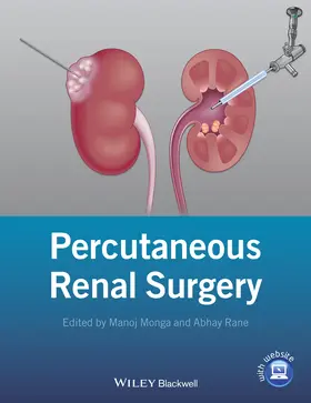 Monga / Rane |  Percutaneous Renal Surgery | Buch |  Sack Fachmedien