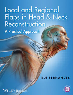 Fernandes |  Local and Regional Flaps in Head and Neck Reconstruction | Buch |  Sack Fachmedien