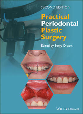 Dibart |  Practical Periodontal Plastic Surgery | Buch |  Sack Fachmedien