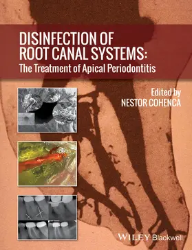 Cohenca |  Disinfection of Root Canal Systems | Buch |  Sack Fachmedien