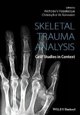 Passalacqua / Rainwater |  Skeletal Trauma Analysis | eBook | Sack Fachmedien