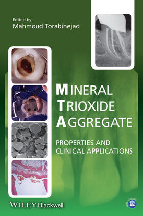 Torabinejad |  Mineral Trioxide Aggregate | Buch |  Sack Fachmedien