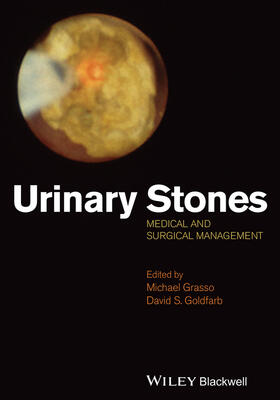 Grasso / Goldfarb |  Urinary Stones | Buch |  Sack Fachmedien