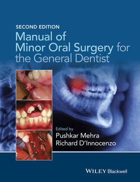 Mehra / D'Innocenzo |  MANUAL OF MINOR ORAL SURGERY F | Buch |  Sack Fachmedien