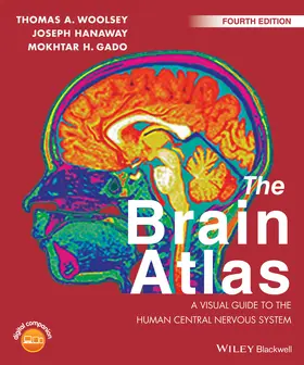 Hanaway / Woolsey / Gado |  The Brain Atlas | Buch |  Sack Fachmedien