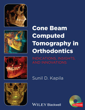 Kapila |  Cone Beam Computed Tomography in Orthodontics | Buch |  Sack Fachmedien