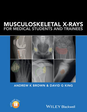 Brown / King |  Musculoskeletal X-Rays for Medical Students and Trainees | Buch |  Sack Fachmedien