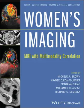 Brown / Ojeda-Fournier / Djilas |  Women's Imaging | Buch |  Sack Fachmedien