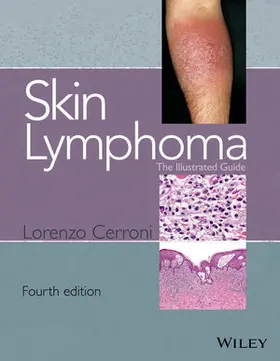 Cerroni |  Skin Lymphoma | Buch |  Sack Fachmedien