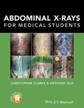 Dux / Clarke |  Abdominal X-rays for Medical Students | Buch |  Sack Fachmedien