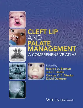 Sándor / Bennun / Genecov |  Cleft Lip and Palate Management | Buch |  Sack Fachmedien