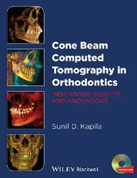 Kapila |  Cone Beam Computed Tomography in Orthodontics | eBook | Sack Fachmedien