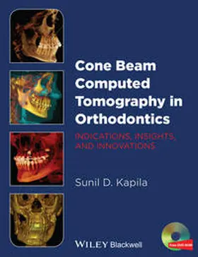 Kapila |  Cone Beam Computed Tomography in Orthodontics | eBook | Sack Fachmedien