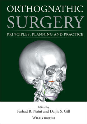 Naini / Gill |  Orthognathic Surgery | Buch |  Sack Fachmedien