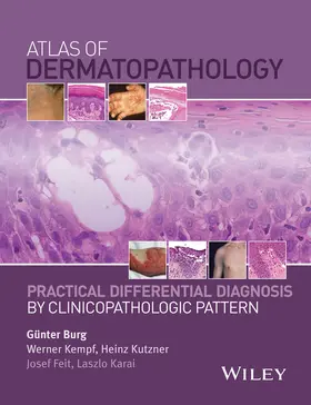 Burg / Kempf / Kutzner |  Atlas of Dermatopathology | Buch |  Sack Fachmedien