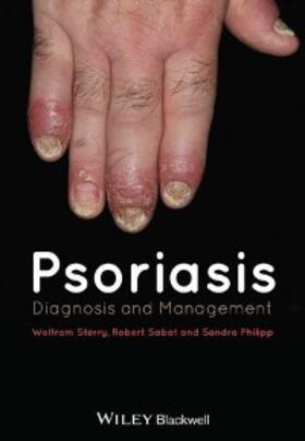 Sterry / Sabat / Philipp |  Psoriasis | eBook | Sack Fachmedien