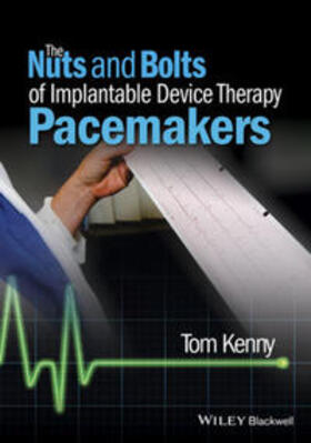 Kenny |  The Nuts and Bolts of Implantable Device Therapy | eBook | Sack Fachmedien