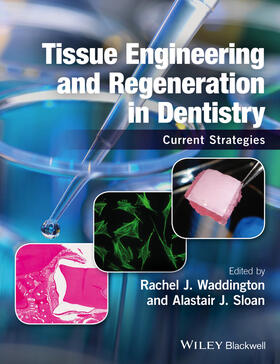Waddington / Sloan |  Tissue Engineering and Regeneration in Dentistry | Buch |  Sack Fachmedien