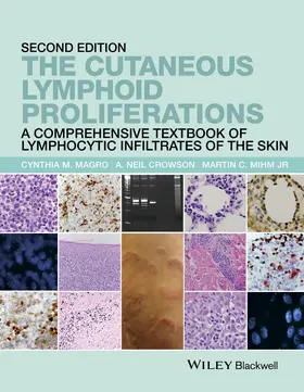 Magro / Crowson / Mihm |  The Cutaneous Lymphoid Proliferations | Buch |  Sack Fachmedien