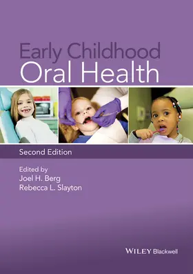 Berg / Slayton |  Early Childhood Oral Health | Buch |  Sack Fachmedien