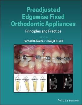 Naini / Gill |  Preadjusted Edgewise Fixed Orthodontic Appliances | Buch |  Sack Fachmedien
