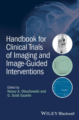 Obuchowski / Gazelle |  Handbook for Clinical Trials of Imaging and Image-Guided Interventions | Buch |  Sack Fachmedien