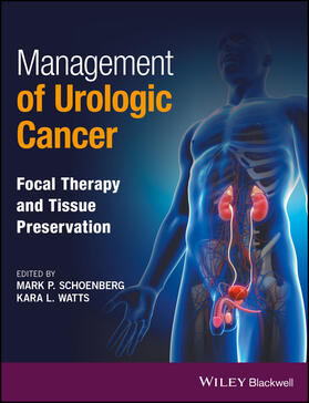 Schoenberg / Watts |  Management of Urologic Cancer | Buch |  Sack Fachmedien