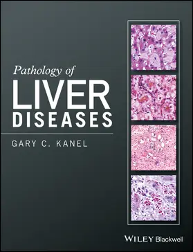 Kanel |  Pathology of Liver Diseases | Buch |  Sack Fachmedien