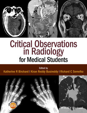 Birchard / Busireddy / Semelka |  Critical Observations in Radiology for Medical Students | Buch |  Sack Fachmedien